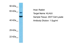 KLHL6 Polyclonal Antibody