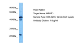 KIAA0391 Antibody in Western Blot (WB)