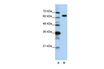 KARS Antibody in Western Blot (WB)