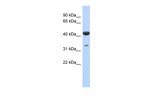 ISPD Polyclonal Antibody