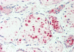 IARS Antibody in Immunohistochemistry (Paraffin) (IHC (P))