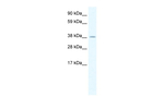 HSFY1/HSFY2 Polyclonal Antibody