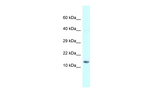 Gm14277 Antibody in Western Blot (WB)