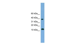 GL54D Antibody in Western Blot (WB)