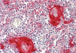 Galectin 7 Antibody in Immunohistochemistry (Paraffin) (IHC (P))