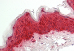 Galectin 7 Antibody in Immunohistochemistry (Paraffin) (IHC (P))