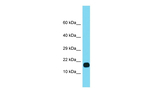 FUOM Polyclonal Antibody
