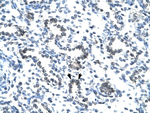 EVX1 Antibody in Immunohistochemistry (IHC)