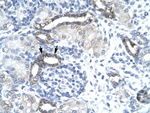 EVX1 Polyclonal Antibody