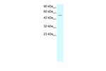 EVX1 Antibody in Western Blot (WB)
