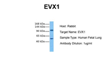 EVX1 Antibody in Western Blot (WB)