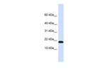 DNAJC25 Polyclonal Antibody