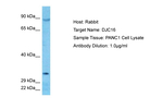 DNAJC16 Antibody in Western Blot (WB)