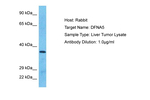 DFNA5 Polyclonal Antibody