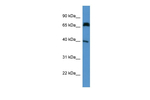 DCDC2 Polyclonal Antibody