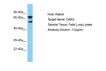 DARS Polyclonal Antibody