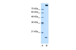 CTAGE5 Antibody in Western Blot (WB)
