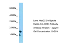 CRB3 Antibody in Western Blot (WB)