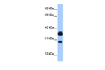 CITED2 Antibody in Western Blot (WB)