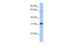 CITED2 Antibody in Western Blot (WB)
