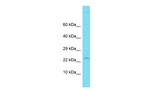 CENPBD1 Polyclonal Antibody