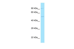 CD97 Antibody in Western Blot (WB)