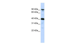 CARS Antibody in Western Blot (WB)