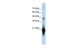 C17orf49 Antibody in Western Blot (WB)