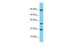 C17orf102 Antibody in Western Blot (WB)
