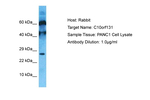 C10orf131 Antibody in Western Blot (WB)