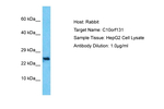 C10orf131 Antibody in Western Blot (WB)
