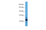 BAZ2B Polyclonal Antibody
