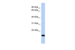 ARL17A/ARL17B Antibody in Western Blot (WB)