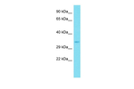Aquaporin 12 Polyclonal Antibody