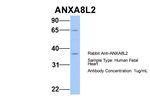 ANXA8L2 Antibody in Western Blot (WB)