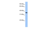 ANXA8L2 Polyclonal Antibody