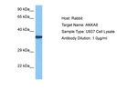 ANXA8L2 Polyclonal Antibody