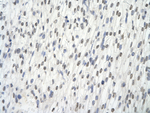 alanyl-tRNA Synthetase Antibody in Immunohistochemistry (Paraffin) (IHC (P))