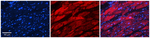 alanyl-tRNA Synthetase Antibody in Immunohistochemistry (Paraffin) (IHC (P))