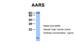 alanyl-tRNA Synthetase Antibody in Western Blot (WB)