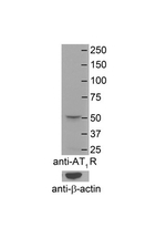 AGTR1 Antibody in Western Blot (WB)
