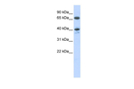 AGTR1 Antibody in Western Blot (WB)