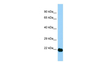 AES Polyclonal Antibody