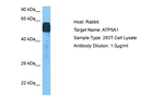 ATP5F1A Antibody in Western Blot (WB)