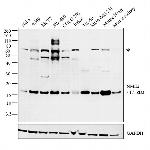 NME2 Antibody in Western Blot (WB)