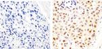 Cyclin D1 Antibody in Immunohistochemistry (Paraffin) (IHC (P))