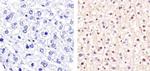 Cyclin D1 Antibody in Immunohistochemistry (Paraffin) (IHC (P))