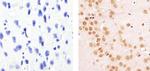 Cyclin E Antibody in Immunohistochemistry (Paraffin) (IHC (P))