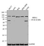 ErbB2 (HER-2) Antibody in Western Blot (WB)