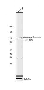 Androgen Receptor Antibody in Western Blot (WB)